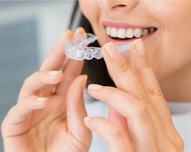 dental aligners aldie va