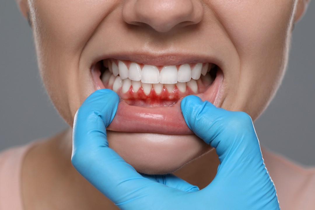 gum disease dentist treatment