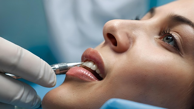 dental bonding porcelain veneers